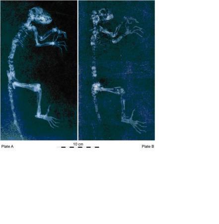 radiographs